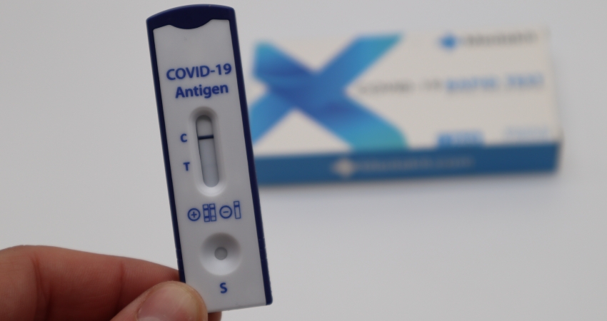 COVID-19: Estudantes de Ciências Farmacêuticas vão ajudar a fazer testes rápidos